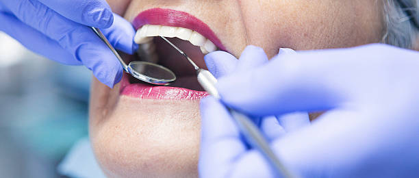 Best Emergency Dental Care for Broken or Chipped Teeth in Red Bank, SC